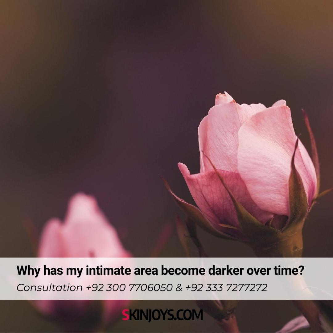 Why has my intimate area become darker over time