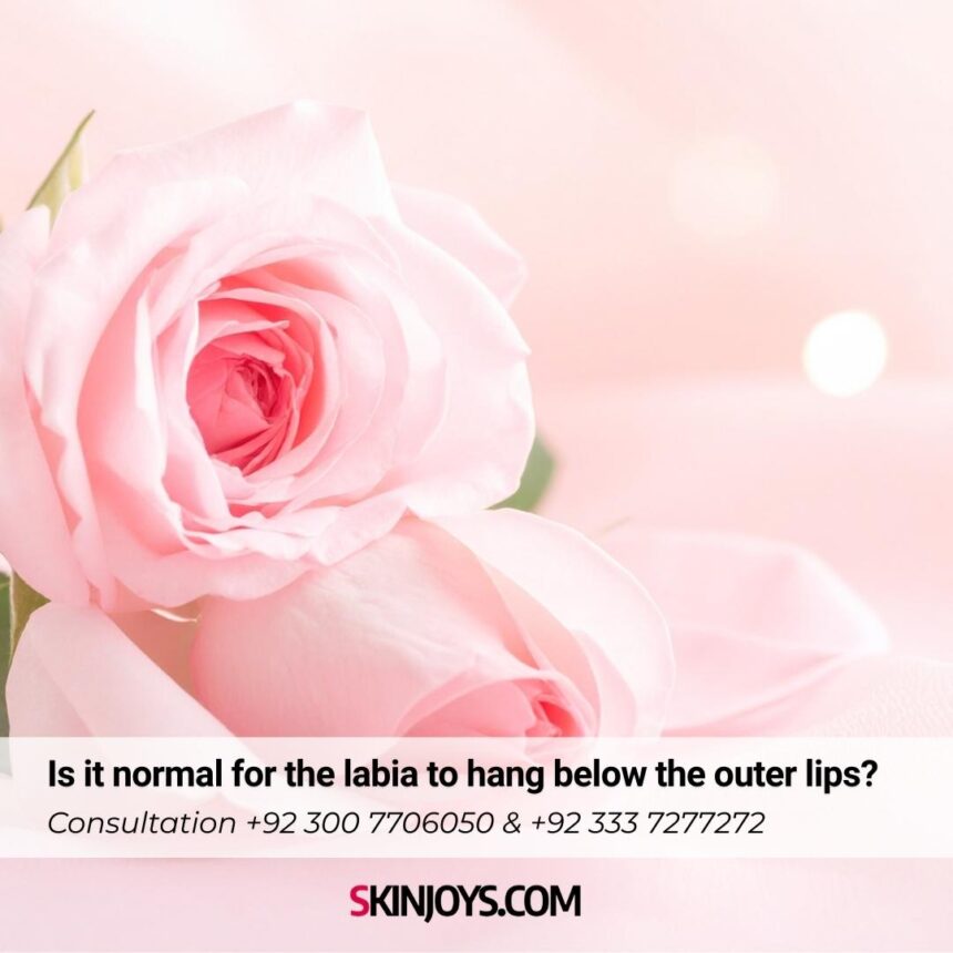 Is it normal for the labia to hang below the outer lips?