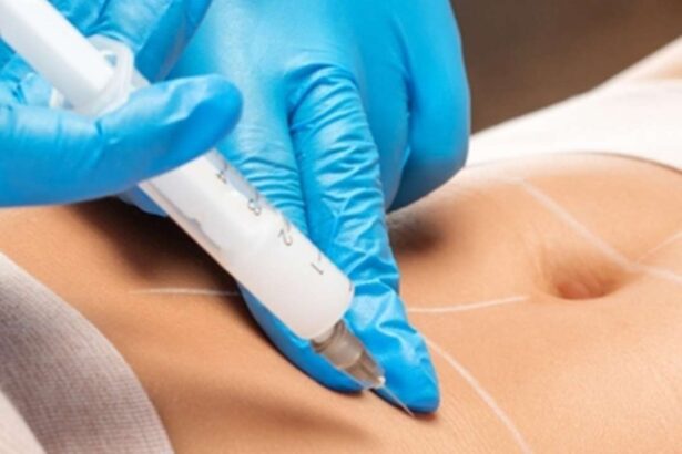 Fat Dissolving Injections