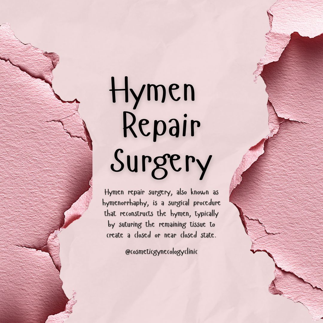 Hymen Repair Surgery