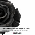 Labia Darkening Causes Myths vs Facts