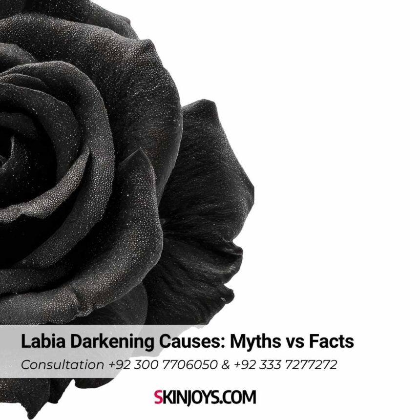 Labia Darkening Causes Myths vs Facts
